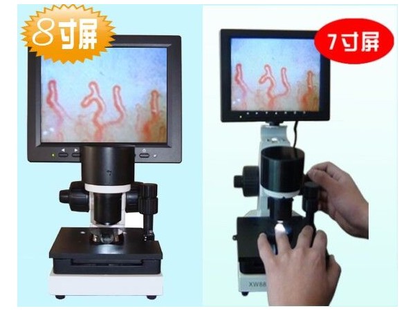 微循環檢測儀 微循環檢測儀招商