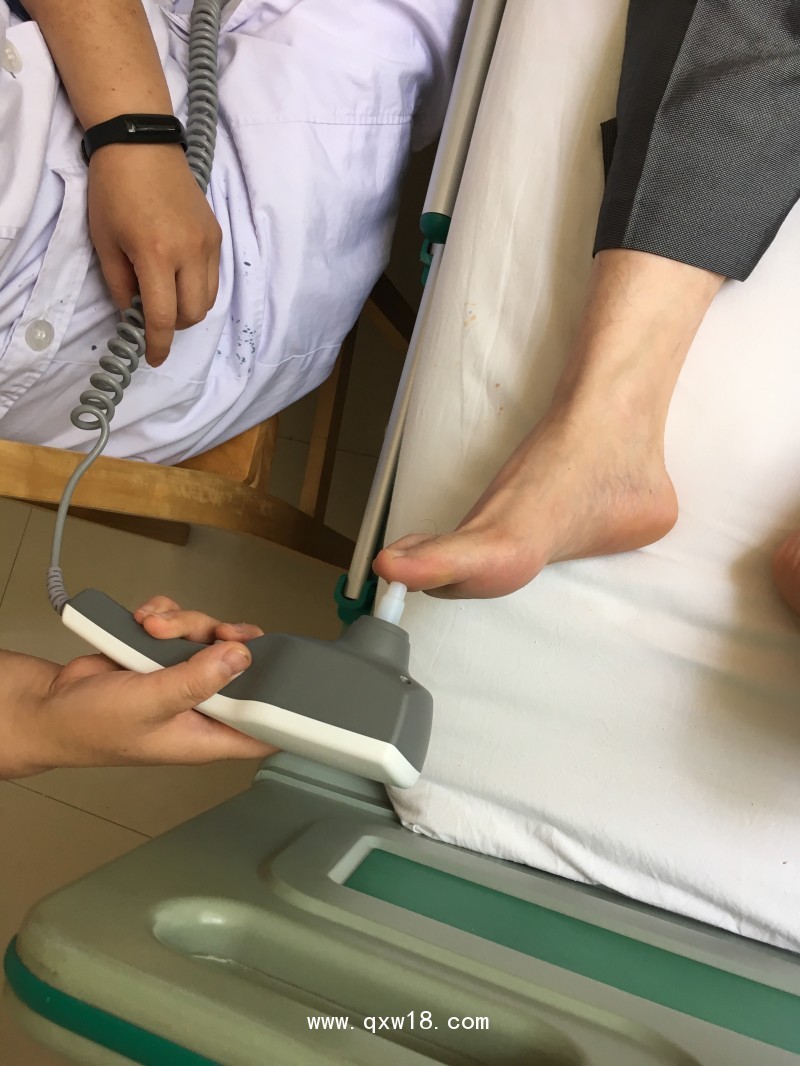 周圍神經檢測儀