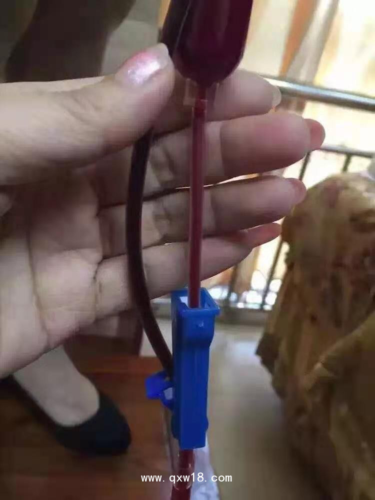 臭氧治療儀―臭氧大自血免疫療法有效治療預防高血脂