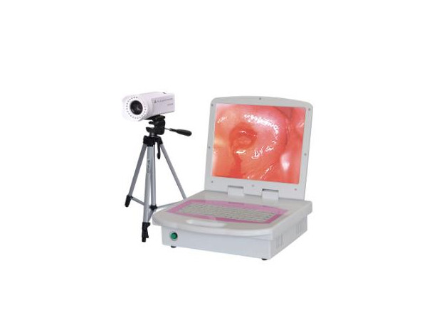 施盟德 數碼電子陰道鏡 RCZ-3001（便攜式）