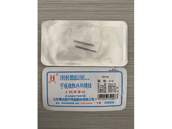 可吸收穴位埋線