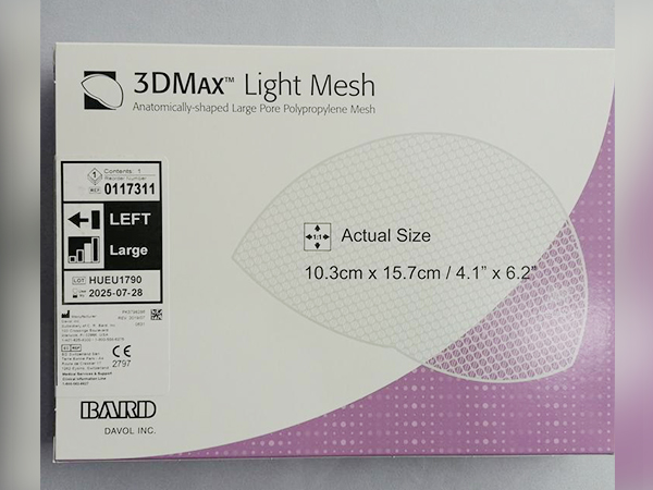 巴德疝修補補片3D