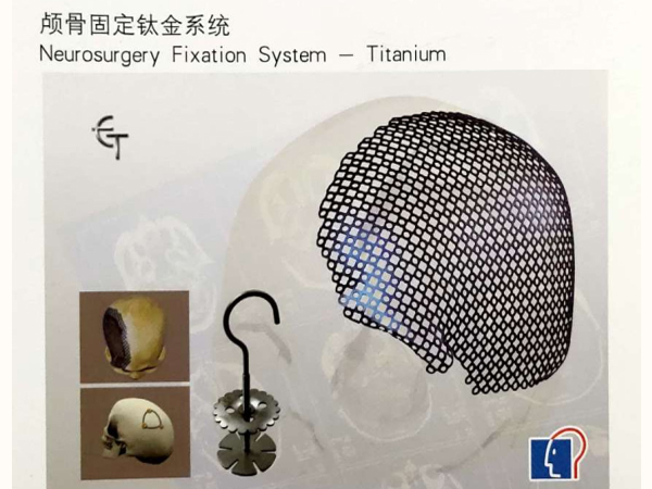 比多亞顱骨固定系統