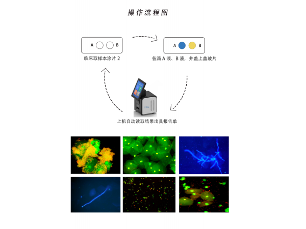 婦科陰道分泌物免疫熒光顯色試劑