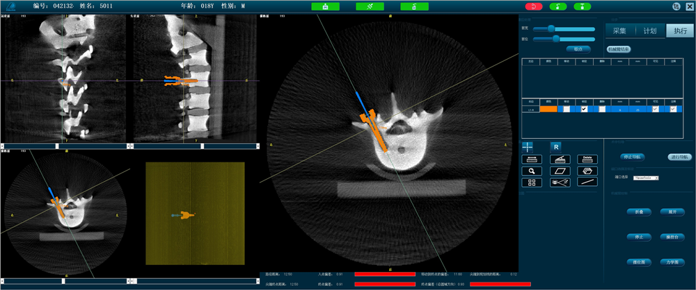 天權骨科手術機器人-準確定位 天權骨科手術機器人-準確定位