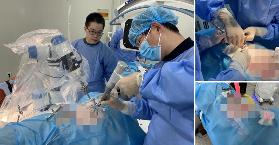 天權骨科手術機器人-手術微創化 天權骨科手術機器人-手術微創化